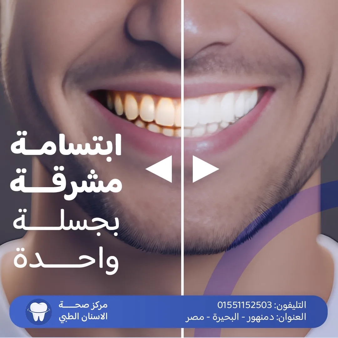 صورة شبكة 6